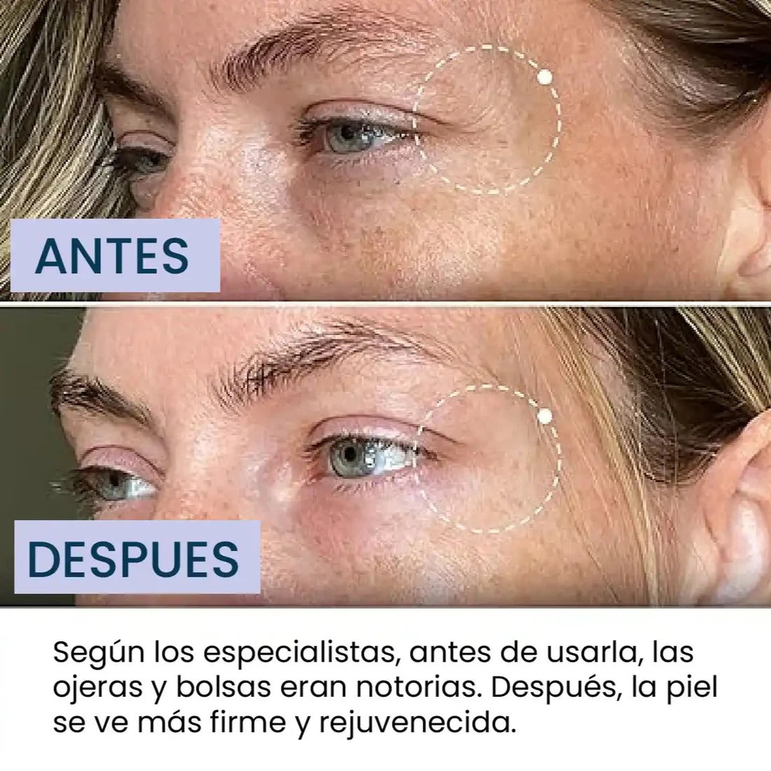 CREMA REPARADORA PARA CUELLO